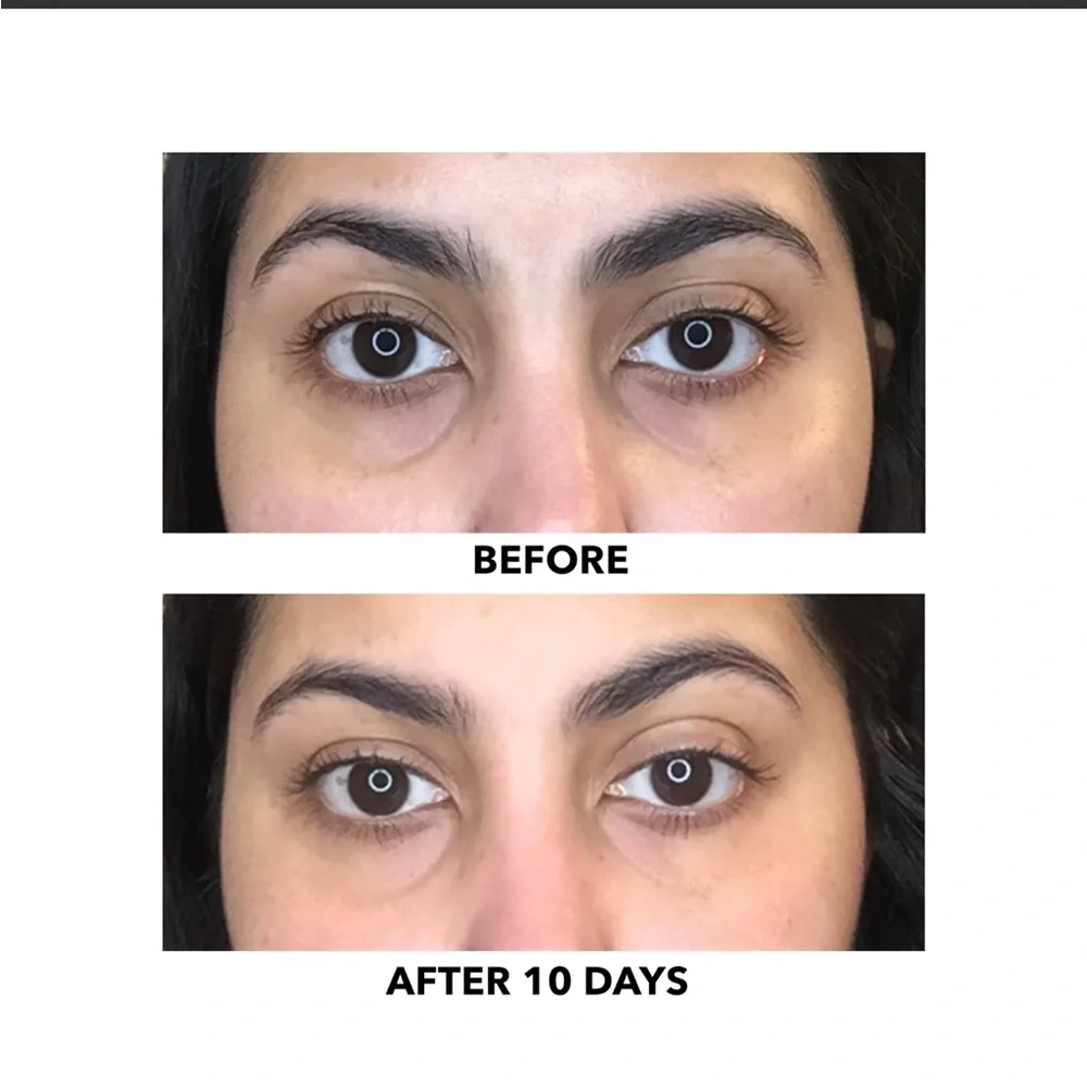 ALGENIST Triple Algae Eye Renewal Balm 0.5oz $68 NIB